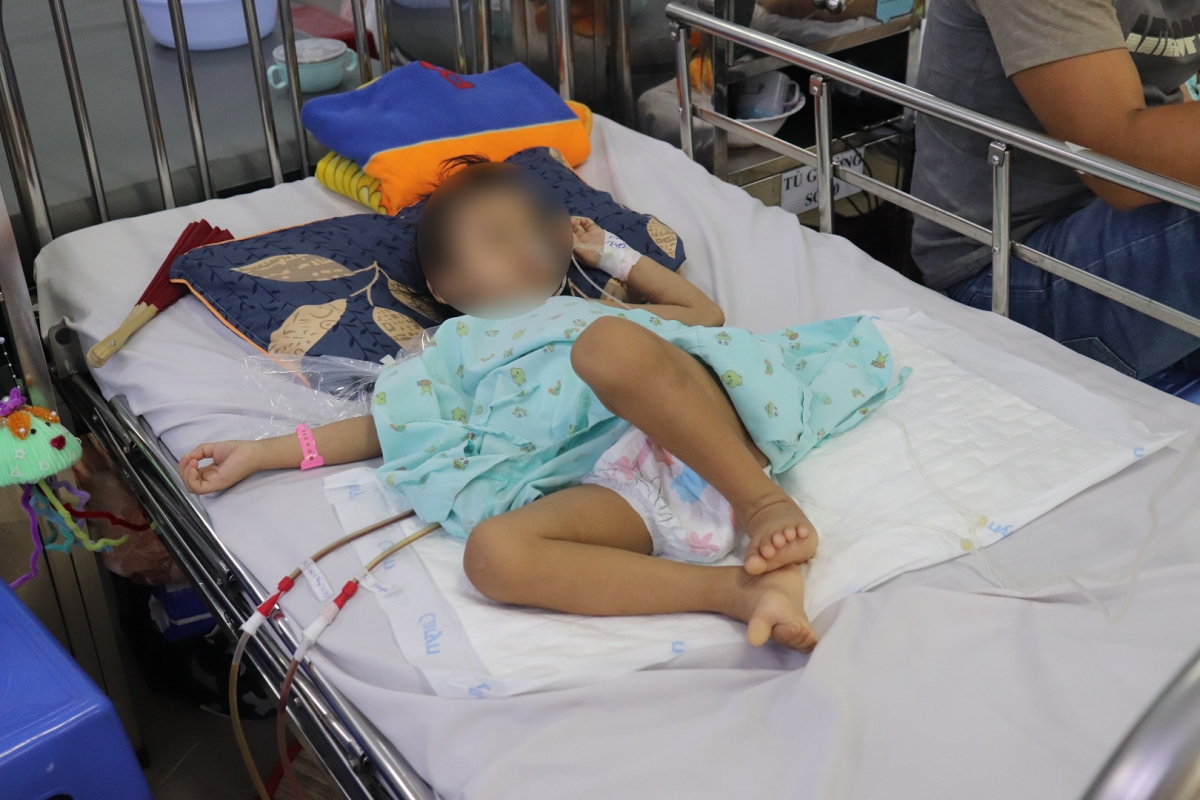 Bé gái 3 tuổi sống sót kỳ diệu với cành cây dài 16cm trong bụng